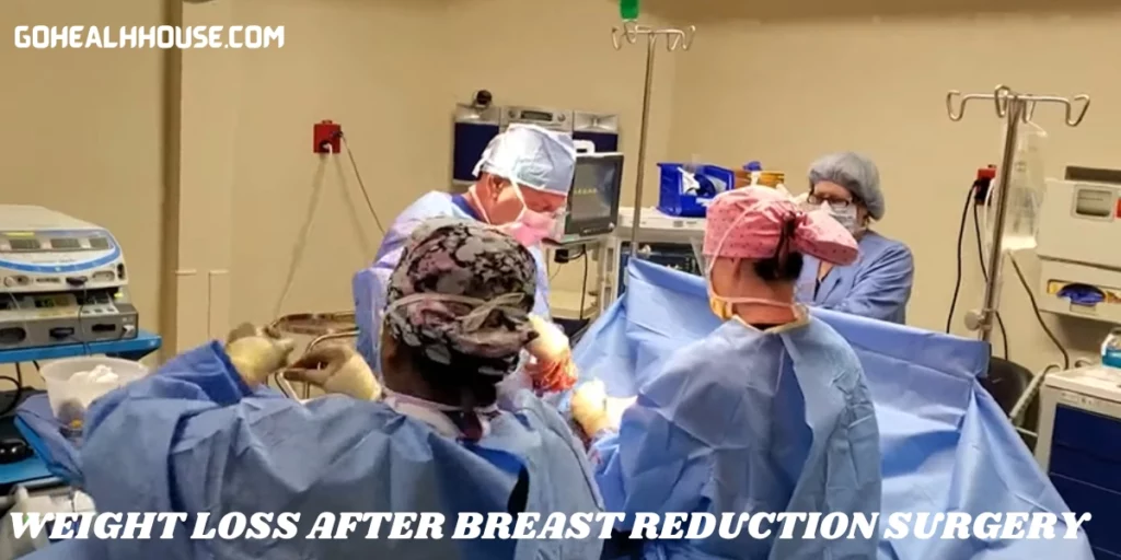 Weight Loss After Breast Reduction Surgery